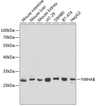 Anti-YWHAB Antibody (CAB1023)