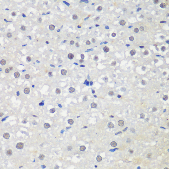 Anti-CTCF Antibody (CAB13272)