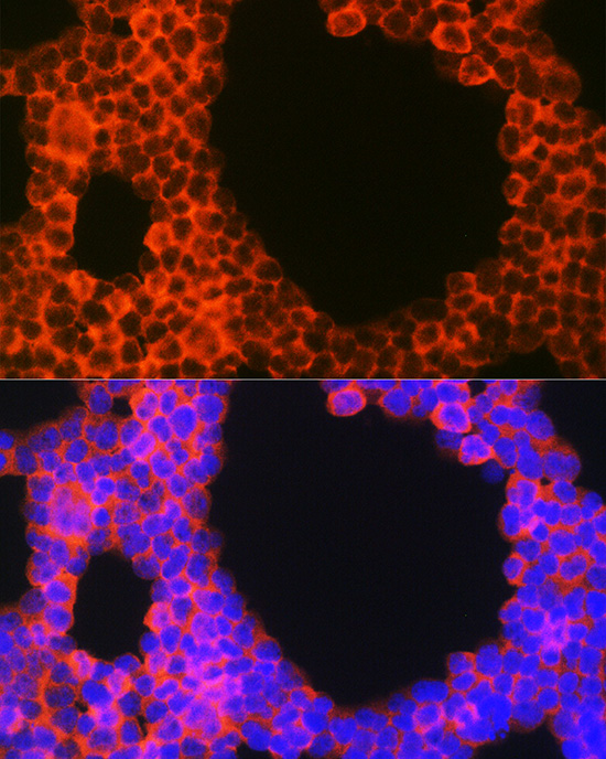 Anti-CD70 Antibody (CAB2032)