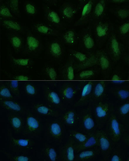 Anti-DUT Antibody (CAB2901)