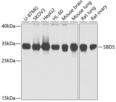 Anti-SBDS Antibody (CAB5876)