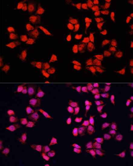 Anti-YBX1 Antibody (CAB15696)