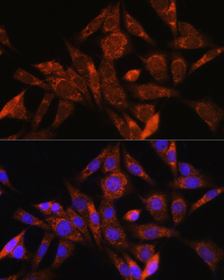 Anti-ANG Antibody (CAB13465)