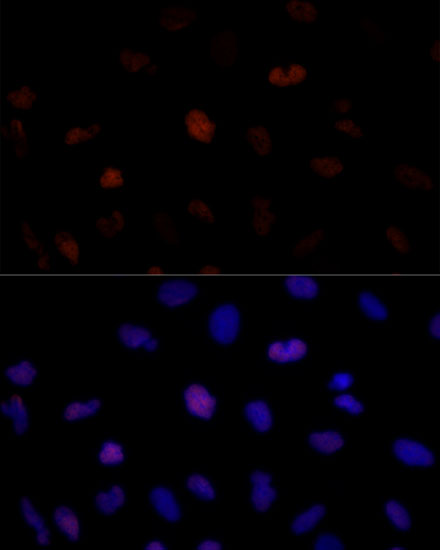 Anti-PSME3 Antibody (CAB12697)