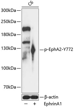 Anti-Phospho-EphA2-Y772 pAb (CABP0817)