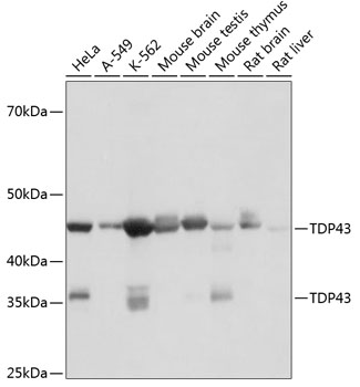 Anti-TDP43 Antibody (CAB19123)