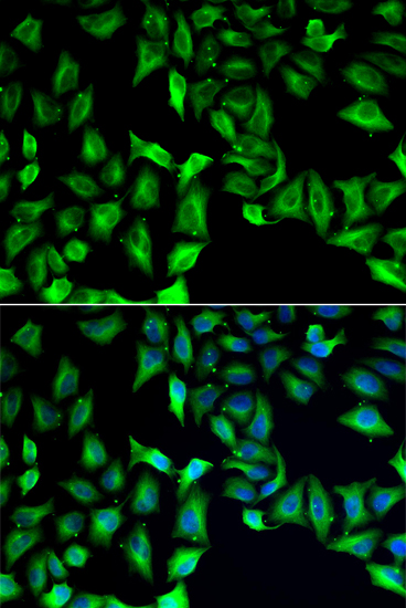 Anti-GDA Antibody (CAB6441)