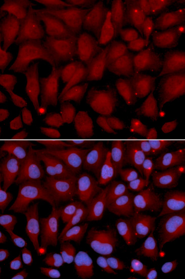 Anti-BCHE Antibody (CAB1460)