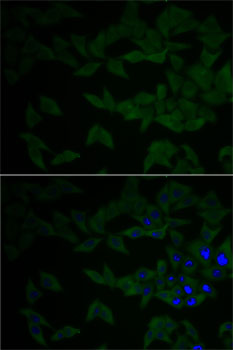 Anti-GNB2L1 Antibody (CAB2560)