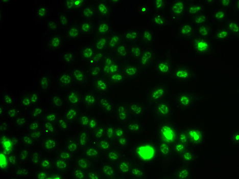 Anti-ETV1 Antibody (CAB13303)