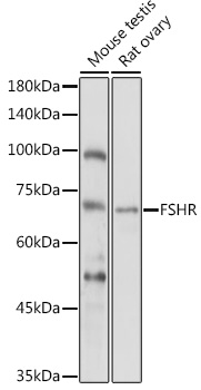 Anti-FSHR Antibody (CAB1480)