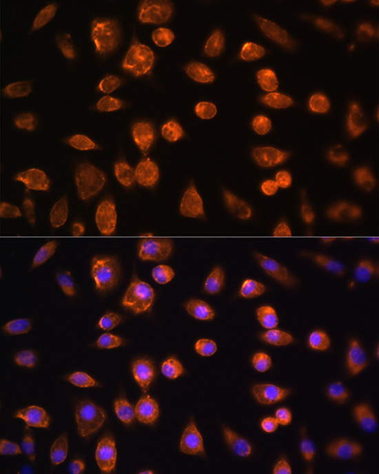 Anti-FLT4 Antibody (CAB5605)