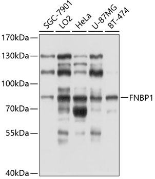 Anti-FNBP1 Antibody (CAB10289)