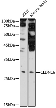 Anti-Claudin-16 Polyclonal Antibody (CAB9862)