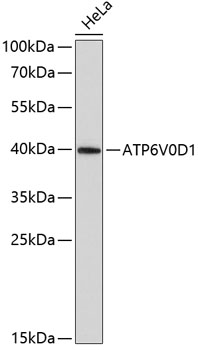 Anti-ATP6V0D1 Antibody (CAB4271)