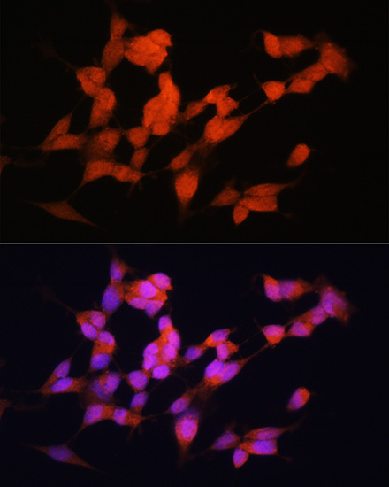 Anti-ELAVL3 Antibody (CAB6091)