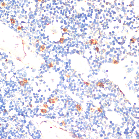 Anti-TLR2 Antibody (CAB0367)