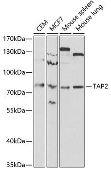 Anti-TAP2 Antibody (CAB1610)