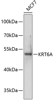 Anti-KRT6A Antibody (CAB7560)