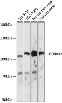 Anti-PTPRN2 Antibody (CAB14774)