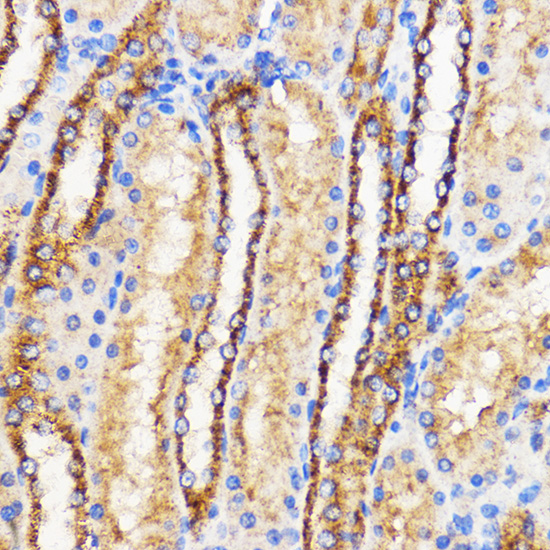 Anti-Mitofusin 2 Antibody (CAB12771)