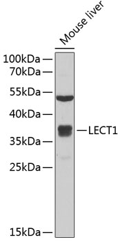 Anti-LECT1 Antibody (CAB6644)
