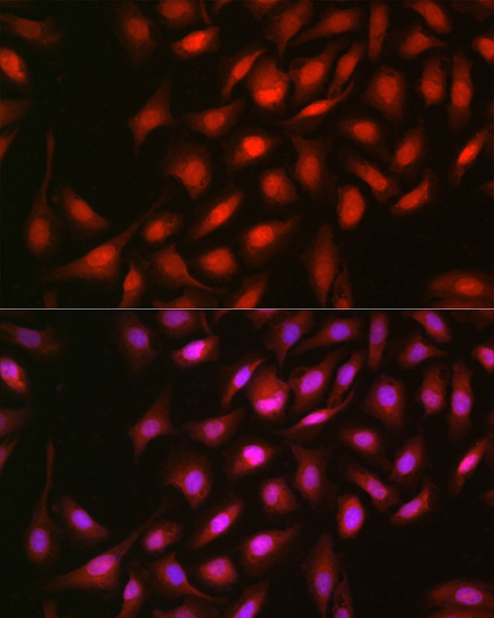 Anti-ERK2 Antibody [KO Validated] (CAB11186)