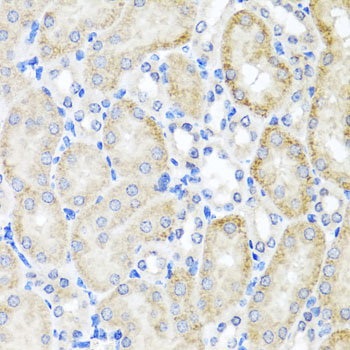 Anti-PSTPIP1 Antibody (CAB7760)