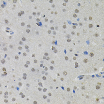 Anti-MKL1 Antibody (CAB12598)