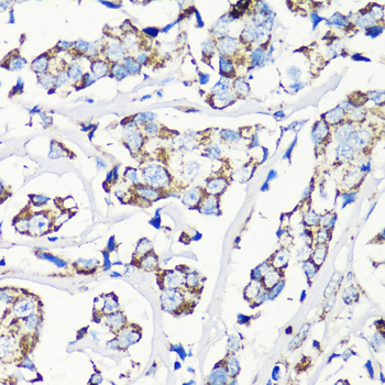 Anti-MMP16 Antibody (CAB10409)