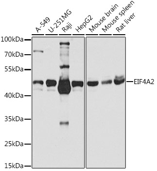 Anti-EIF4A2 Antibody (CAB3849)