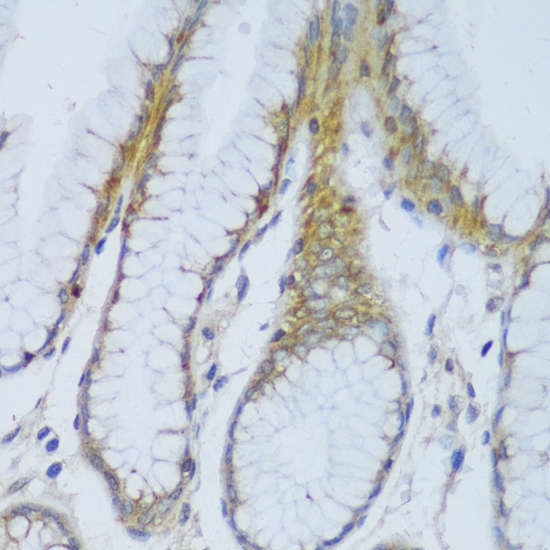 Anti-CRACR2A Antibody (CAB13838)