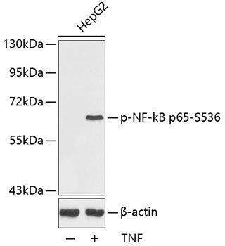 Anti-Phospho-RELA-S536 Antibody (CABP0124)