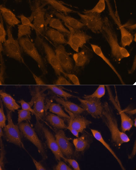 Anti-STUB1 Antibody (CAB11751)