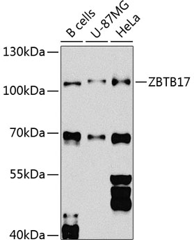 Anti-ZBTB17 Polyclonal Antibody (CAB8463)