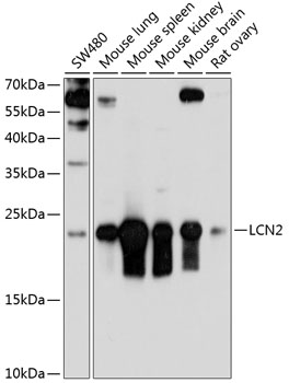 Anti-LCN2 Antibody (CAB3176)