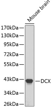 Anti-DCX Antibody (CAB1134)