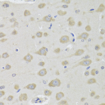 Anti-DHRS9 Antibody (CAB6324)