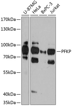 Anti-PFKP Antibody (CAB12160)