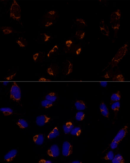 Anti-MTCH2 Antibody (CAB12934)