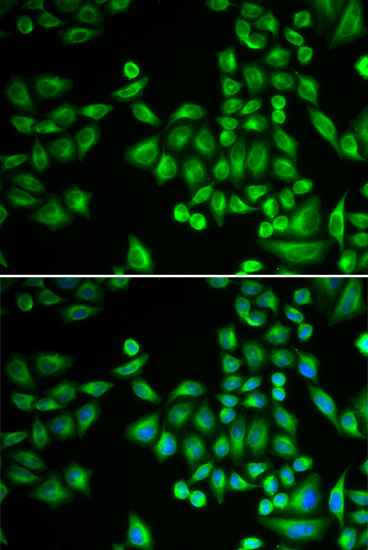 Anti-PTPN1 Antibody [KO Validated] (CAB1590)