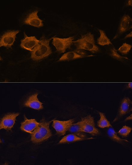 Anti-ATP1B2 Polyclonal Antibody (CAB9928)