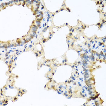 Anti-CCL11 Antibody (CAB7569)