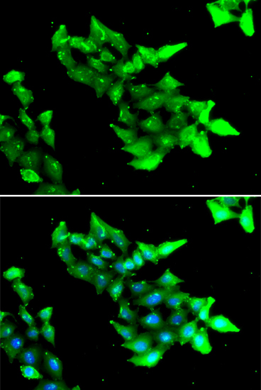 Anti-KRIT1 Antibody (CAB6881)