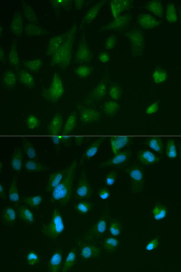 Anti-ARRB1 Antibody (CAB0998)