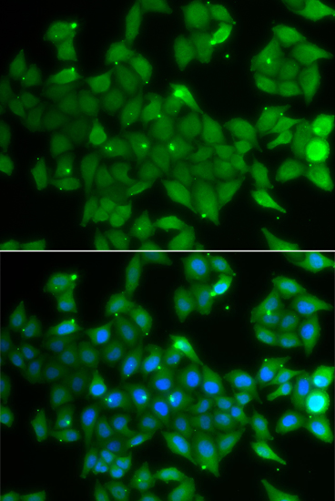 Anti-ANXA11 Antibody (CAB7423)