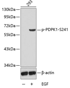 Anti-Phospho-PDPK1-S241 Antibody (CABP0426)