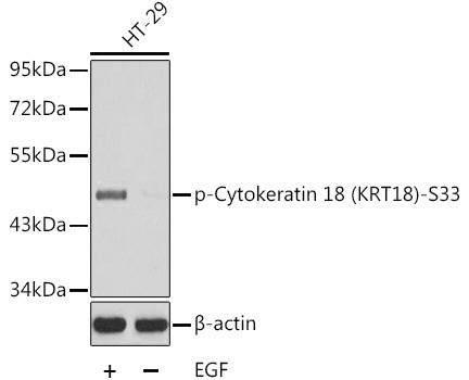 Western blot analysis of extracts from HT29 cells untreated or treated with EGF using Phospho-Cytokeratin 18 (KRT18)-S33 antibody . Secondary antibody: HRP Goat Anti-Rabbit IgG (H+L) at 1:10000 dilution. Lysates/proteins: 25ug per lane. Blocking buffer: 3% BSA.