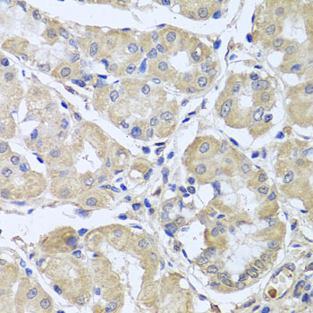 Anti-CEP57L1 Polyclonal Antibody (CAB8290)