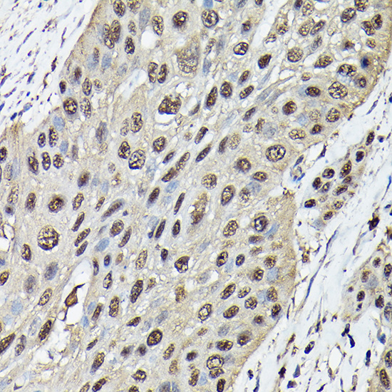 Anti-Ataxin 3 Antibody (CAB1243)